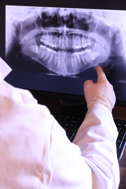 Best Emergency Dentist for Knocked-Out Tooth in Park Hills, KY