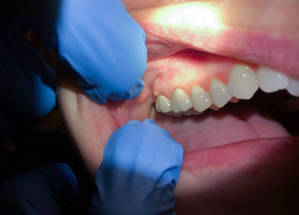 Best Urgent Dental Care for Toothache in Park Hills, KY