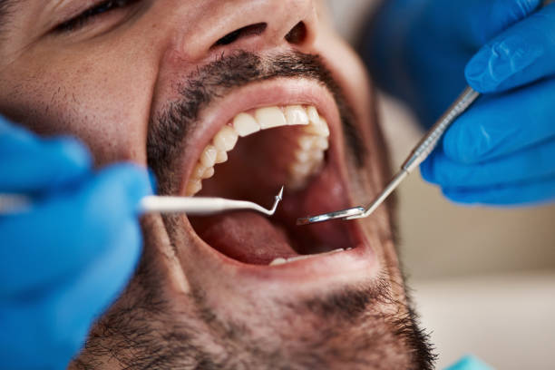 Best Emergency Root Canal Treatment in Park Hills, KY